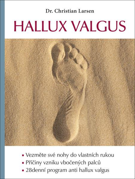Hallux valgus - Christian Larsen