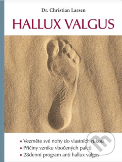 Hallux valgus - Christian Larsen