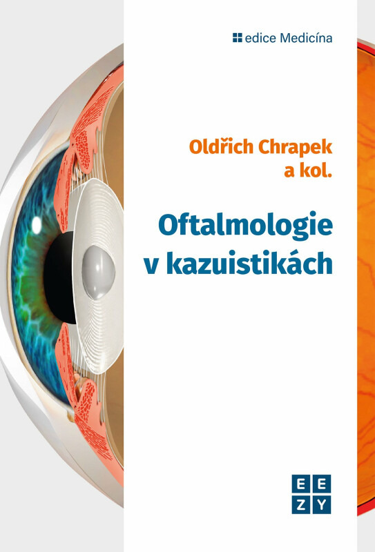 Oftalmologie v kazuistikách - Oldřich Chrapek, kolektiv autorů