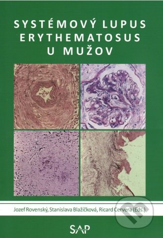 Systemovy lupus erythematosus u muzov - Jozef Rovenský, Stanislava Blažičková - kniha z kategorie Medicína
