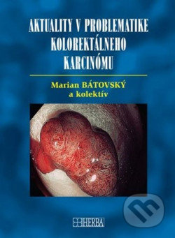 Aktuality v problematike kolorektálneho karcinómu - Marián Bátovský a kolektív - kniha z kategorie Onkologie
