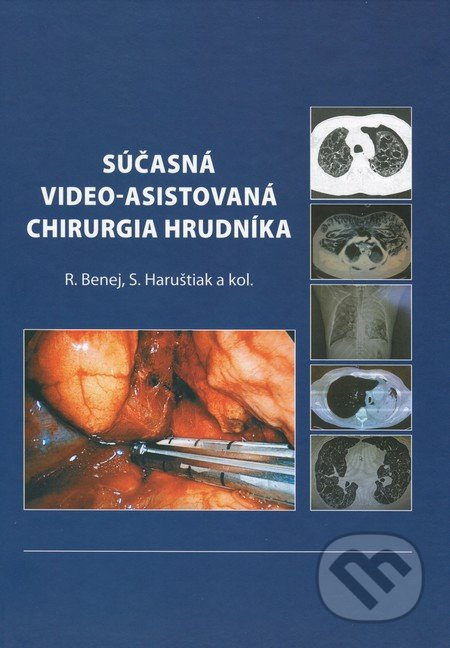 Súčasná video-asistovaná chirurgia hrudníka - Roman Benej, Svetozár Haruštiak a kolektív - kniha z kategorie Chirurgie