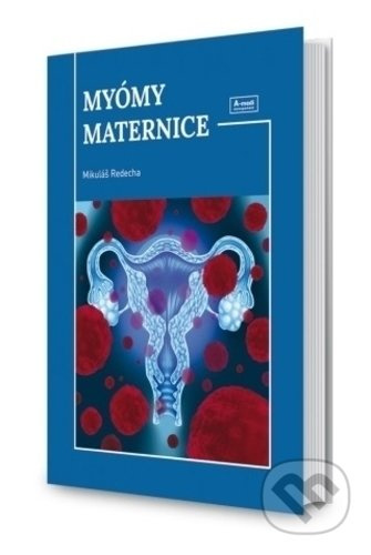 Myómy maternice - Mikuláš Redecha - kniha z kategorie Medicína