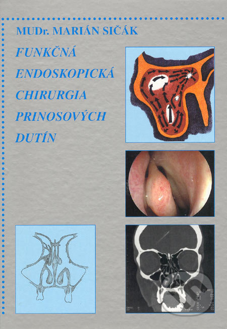Funkčná endoskopická chirurgia prinosových dutín - Marián Sičák