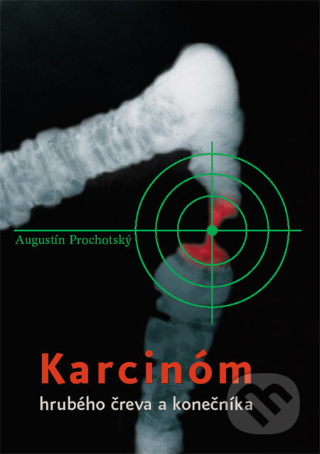 Karcinóm hrubého čreva a konečníka - Augustín Prochotský - kniha z kategorie Nefrologie a gastroenterologie