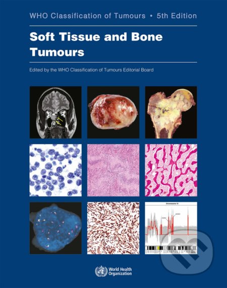 Soft Tissue and Bone Tumours (Who Classification of Tumours (5th Edition, Volume 3)) - kniha z kategorie Medicína