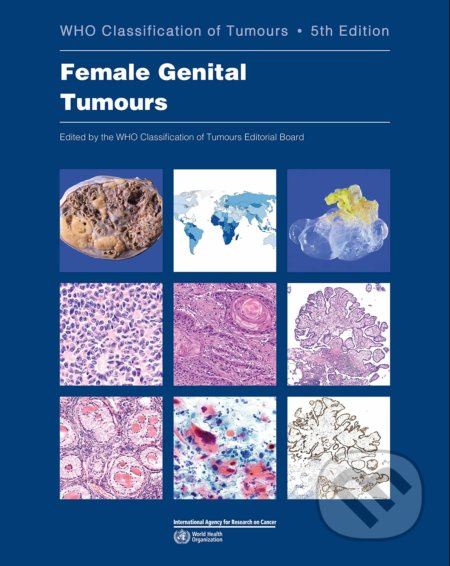 Female Genital Tumours (WHO Classification of Tumours) - kniha z kategorie Medicína