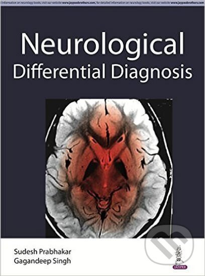 Differential Diagnosis in Neurology 1st Edition - kniha z kategorie Neurologie