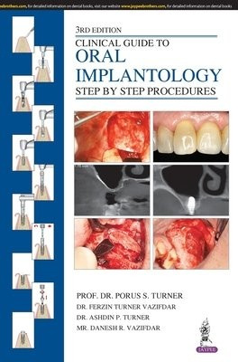 Clinical Guide to Oral Implantology, Step by Step Procedures Jaypee Brothers Medical Publishers