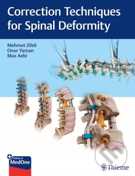 Correction Techniques for Spinal Deformity - Max Aebi, Onur Yaman, Mehmet Zileli - kniha z kategorie Chirurgie